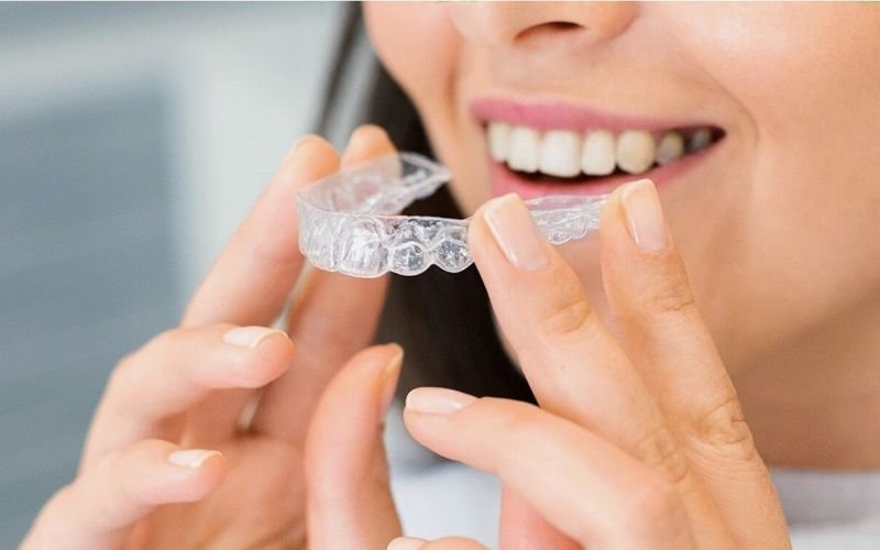Invisalign